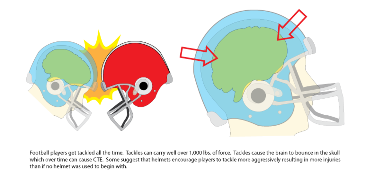 Football-Helmets